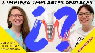 LIMPIEZA DE IMPLANTES DENTALES 🦷 con Dra Edith Godínez Padilla [upl. by Aztiraj113]