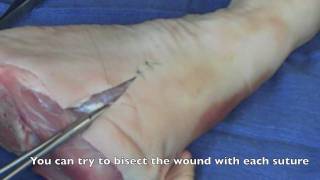 Suture  Basic Technique 2 [upl. by Eardnaed887]