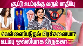 வெள்ளைப்படுதல் பிரச்சனைக்கு நிரந்தர தீர்வு  Dr Sharmika Easy Tips White Discharge [upl. by Meeki]