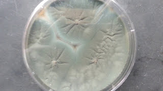 penicillium growth on SDA [upl. by Butte304]