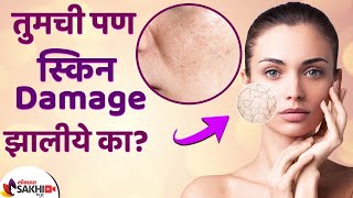 Damage Skin साठी करा हा घरगुती उपाय  How to Repair Damaged Skin  Damaged Skin Barrier [upl. by O'Doneven]