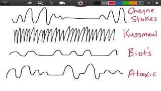 Irregular Breathing Patterns  EMTprepcom [upl. by Otrebide]