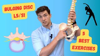 Bulging Disc L5S1 The 5 Best Exercises Explained in Detail [upl. by Gipps]