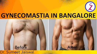 Gynecomastia In Bangalore  Gynecomastia Surgery  Gynecomastia Specialists  Zenith Clinic [upl. by Ozneral]