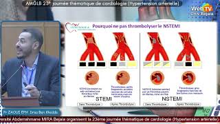 Communication du Pr ZAOUI EPH de Draa Ben Khedda Syndrome coronarien aigue [upl. by Hannasus]