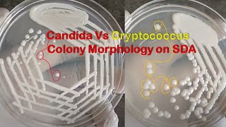 Candida and Cryptococcus Colony Morphology on Sabouraud dextrose agar SDA Demonstration [upl. by Baese640]