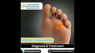 Morton’s neuroma diagnosis and treatment in kaushambi metro station Ghaziabad mortonsneuroma [upl. by Walkling472]