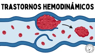 TRASTORNOS HEMODINÁMICOS Hiperemia Congestión Edema Efusión Hemostasia Trombosis y Embolismo [upl. by Machute]