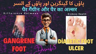 Gangrene foot versus Diabetic foot ulcer  Diabetic Gangrene Foot  Diabetic foot ulcer [upl. by Gabrielle994]