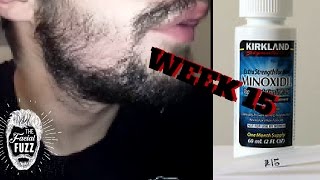 Minoxidil Beard  Week 15  Minoxidil 5 for Beard Growth  FacialFuzzFridays [upl. by Moulden]