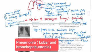 Pneumonia  Lobar and bronchopneumonia Respiratory 48  First Aid USMLE Step 1 in UrduHindi [upl. by Rosenblast]