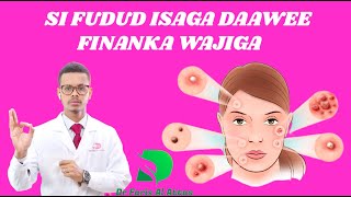 FINANKA WAJIGA SIDA UGU FUDUD EE LEYSAGA DAAWEEYO IYO WAXYAABAHA KEENO  Dr faris [upl. by Elsi125]