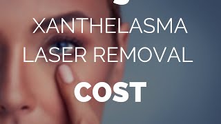 Xanthelasma laser removal cost is it worth it [upl. by Nashoma]