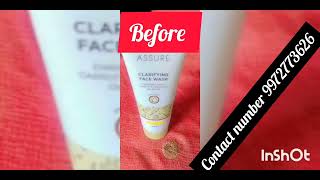 Best FACE WASH review ASSURE CLARIFYING face wash [upl. by Auqenes89]