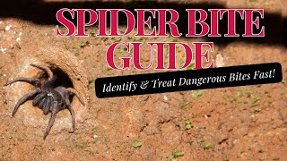 Spider Bite Guide Identify amp Treat Dangerous Bites Fast [upl. by Ocirederf753]