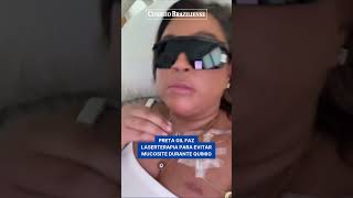 PRETA GIL FAZ LASERTERAPIA NA BOCA PARA EVITAR MUCOSITE DURANTE QUIMIO [upl. by Ameerahs468]