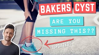 BAKERS CYST Exercises You Should Be Doing Updated [upl. by Ajssatan]