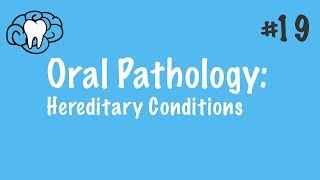 Oral Pathology  Hereditary Conditions  INBDE ADAT [upl. by Sirmons30]