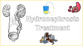 Hydronephrosis Treatment  Medical amp Surgical Management Of Hydronephrosis [upl. by Hnim172]