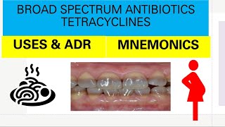 PHARMACOLOGY TETRACYCLINESCLASSIFICATIONPHARMACOKINETICSUSES ADRMNEMONICSIN TAMIL [upl. by Leonanie]