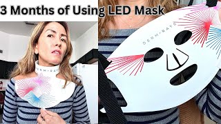 DermRays Light Therapy Mask Review 3 Months Later BIG Results [upl. by Luahs691]