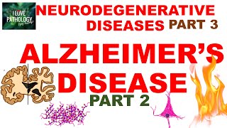 NEURODEGENERATIVE DISEASES PART 3 ALZHEIMER DISEASE Morphology Clinical Features amp Treatment [upl. by Friday]