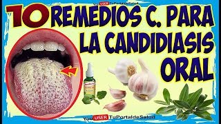 10 Remedios Caseros para la Candidiasis Oral – Como Combatir la Cándida en la Boca [upl. by Noirrad766]