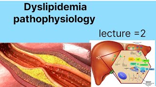 Pathophysiology of hyper dyslipidemia  dyslipidemia types and causes  hypercholesteolemia [upl. by Daenis]