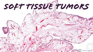 Soft Tissue Pathology epithelioid fibrous histiocytoma ALK1 atypical FH paraganglioma and more [upl. by Brittni]