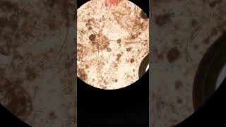 sarcoptic scabiei  sarcoptic mange canine scabies under microscope [upl. by Nahgam992]