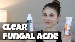 SKIN CARE PRODUCTS TO CLEAR FUNGAL ACNE DR DRAY [upl. by Ellswerth]