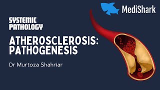 Systemic Pathology Atherosclerosis Class 2 Pathogenesis Dr Murtoza Shahriar [upl. by Lexa]