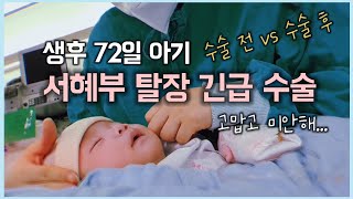 서혜부 탈장  신생아 탈장 수술 후기  신생아딤플  생후 72일  쌍둥이 육아 신생아 브이로그  아들둥이  러블리유즈 [upl. by Wadlinger]