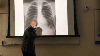 Chest xray positioning [upl. by Amador]