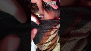 Anisocoria EYE 👁️ Medical points 🤔 आप भी चेक कर लो armymedical viralvideo [upl. by Novat992]