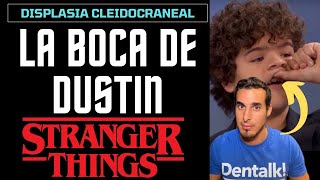 STRANGER THINGS ¿Qué le pasa a Dustin en los dientes La extraña enfermedad que tiene [upl. by Milburr155]