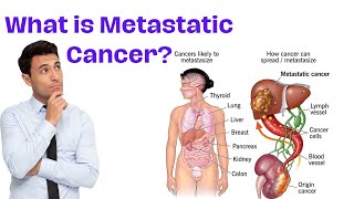 Understanding Metastasis  What is Metastatic Cancer [upl. by Initof]