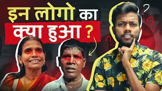 Kaccha Badam amp Ranu Mandal ये लोग का क्या हुआ [upl. by Dorthea]