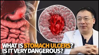 What is Stomach Ulcer What causes it and how dangerous is it when left untreated [upl. by Drareg]