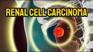 Renal Cell Carcinoma Kidney Cancer  CRASH Medical Review Series [upl. by Ardnalak665]