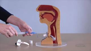 Tracheostomy  Respiratory phonatory and swallowing function  TRACS WA [upl. by Reggie]