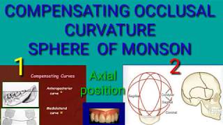 COMPENSATING OCCLUSAL CURVATURE OR SPHERE OF MONSON  AXIAL POSITION  ZEE DENTAL CHANNEL [upl. by Pauli]