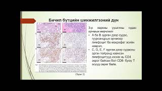 Interstitial pneumonia in immunocompetent laboratory rats caused by Pneumocystis carinii [upl. by Drauode]