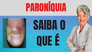 Paroníquia Saiba o Que é E Como Tratar [upl. by Noral]