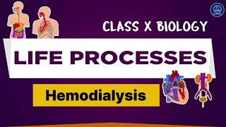 Hemodialysis l Artificial kidney l Life Processes Class 10th biology [upl. by Philemon]