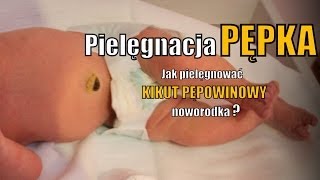 Pielęgnacja pępka i kikuta pępowinowego [upl. by Inalawi342]