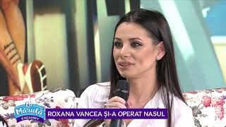 Roxana Vancea sia operat nasul [upl. by Amery]