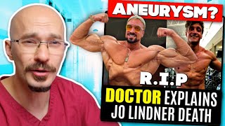 DOCTOR Explains Jo Lindner quotJoestheticsquot Death  Aneurysm [upl. by Qiratla591]