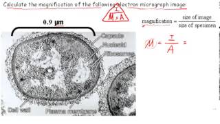 Calculating Magnification IB Biology [upl. by Hewart]