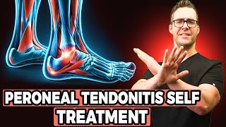 Peroneal Tendonitis Self Treatment Stretches Exercises amp Massage [upl. by Seeto203]